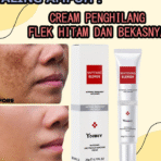YouBuy Blemish & Frackle Removing Cream - Image 5