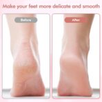 Rechargable Flawless Pedicure Tool For Foot Cleaning - Image 5