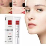 YouBuy Blemish & Frackle Removing Cream - Image 6